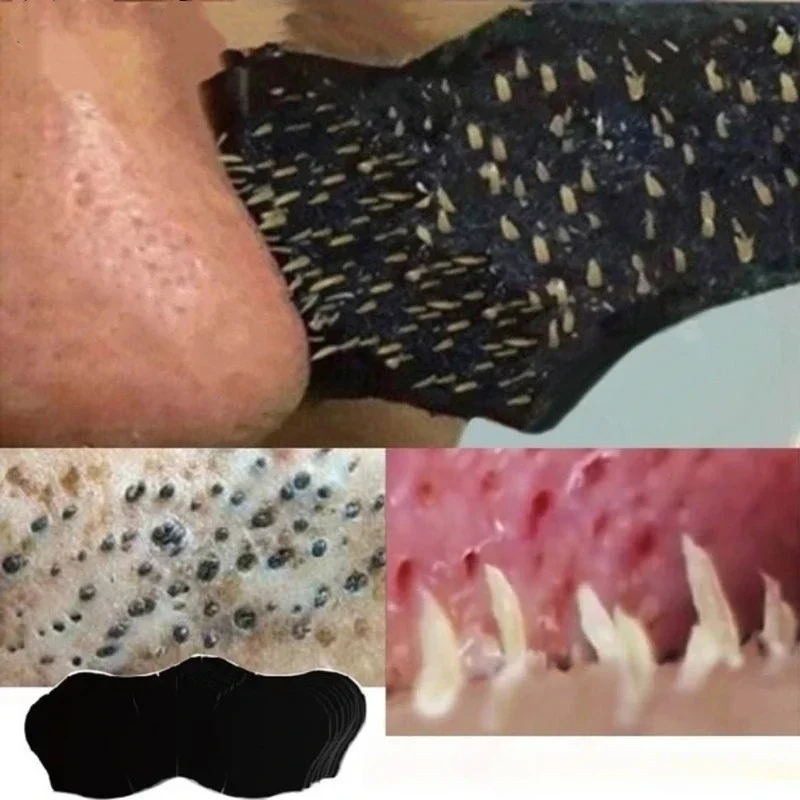 Skincare Viral Tiktok - Unisex Blackhead Remove Mask Nasal Strips