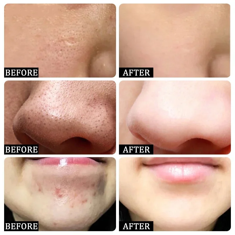 Salicylic Acid Pore Clearing C - Skincare Salicylic Acid review and price
