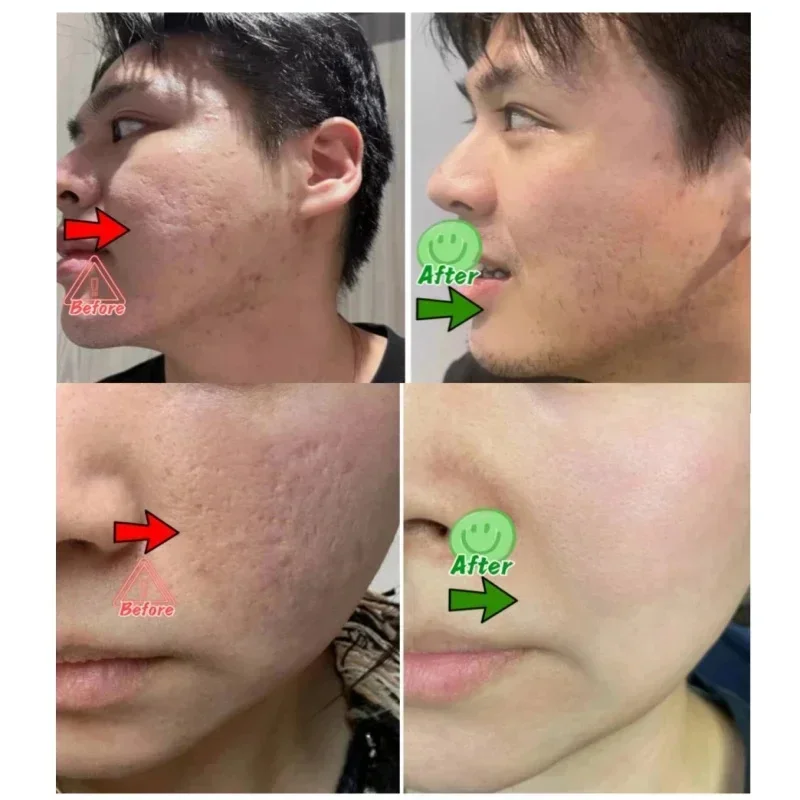 Salicylic Acid Pore Clearing C - Skincare Salicylic Acid review and price