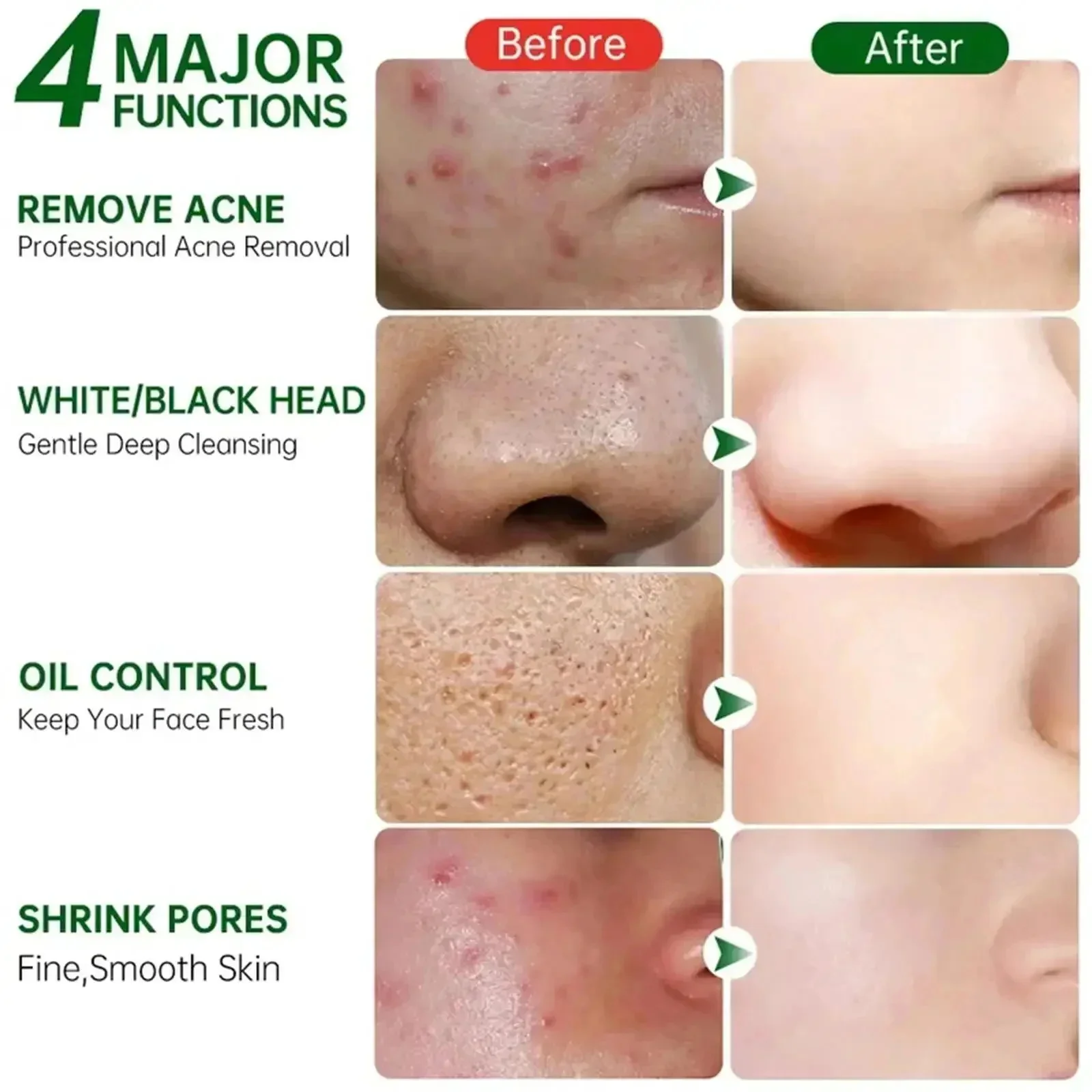 Salicylic Acid Pore Clearing C - Skincare Salicylic Acid review and price