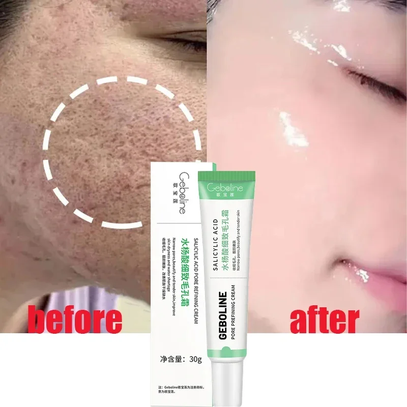Salicylic Acid Pore Shrinking  - Skincare Salicylic Acid review and price